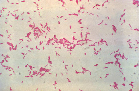 Ralstonia picketti